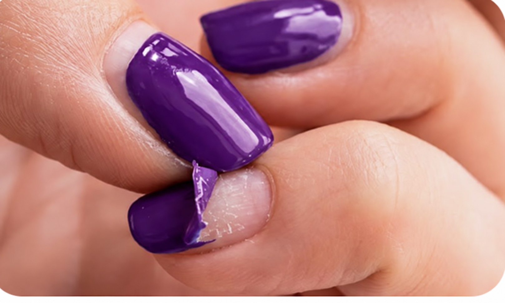 Esmalte morado que se desprende en una lámina y deja parte de la uña visible; color editado con IA