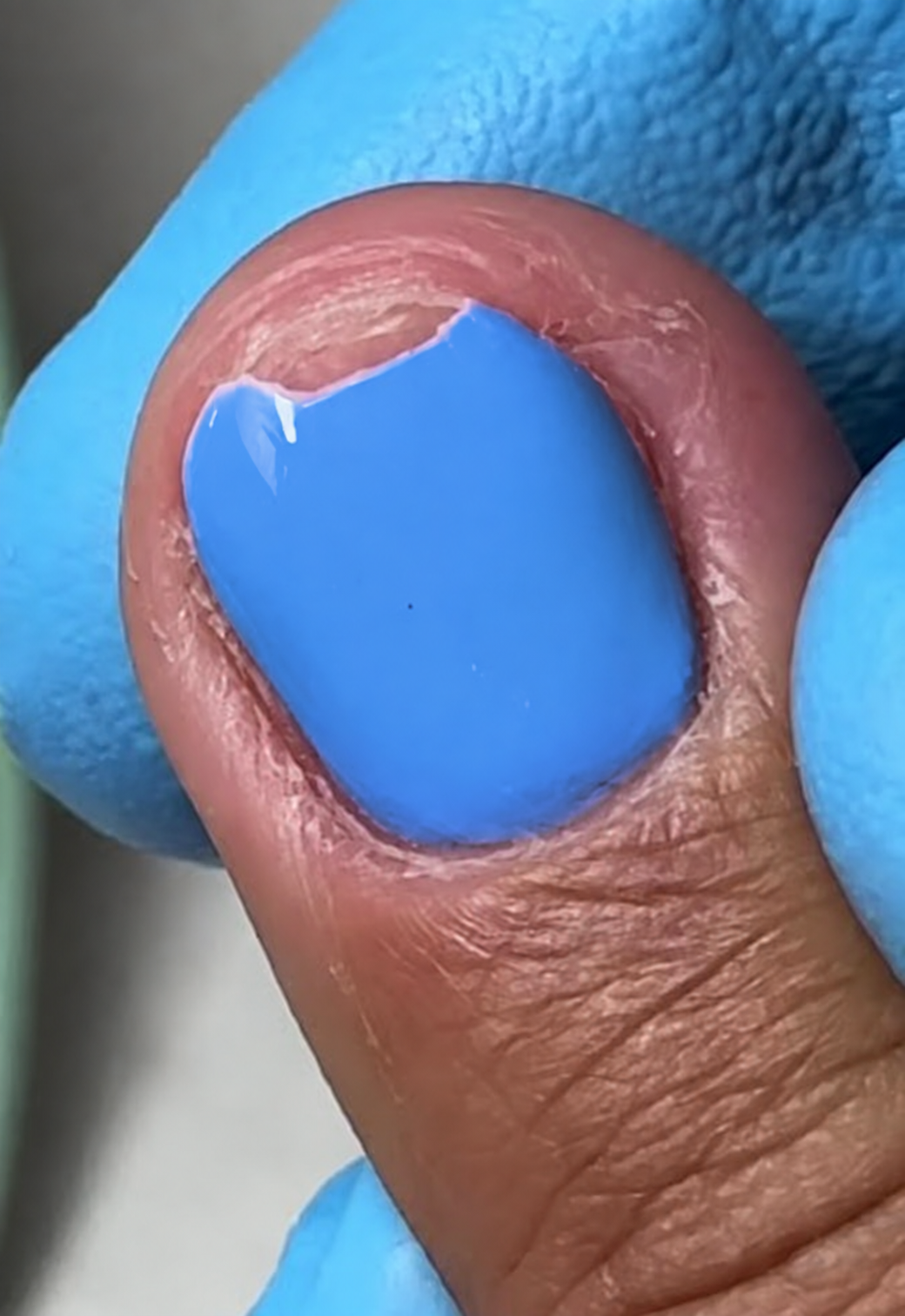 Esmalte azul con pérdida de recubrimiento en la punta; color editado con IA