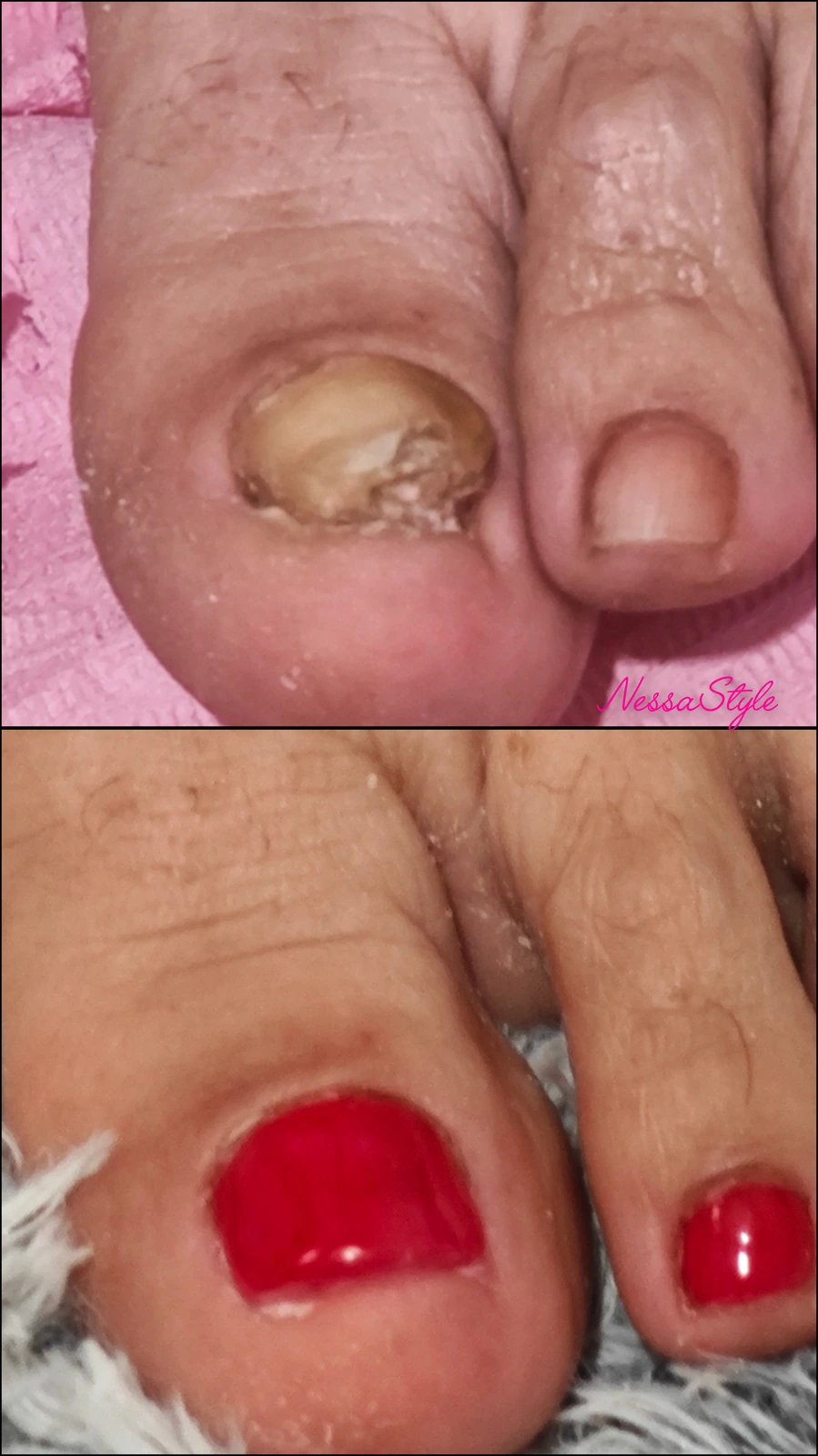Antes · Uñas problemáticas · detalle · trabajo de alumna
