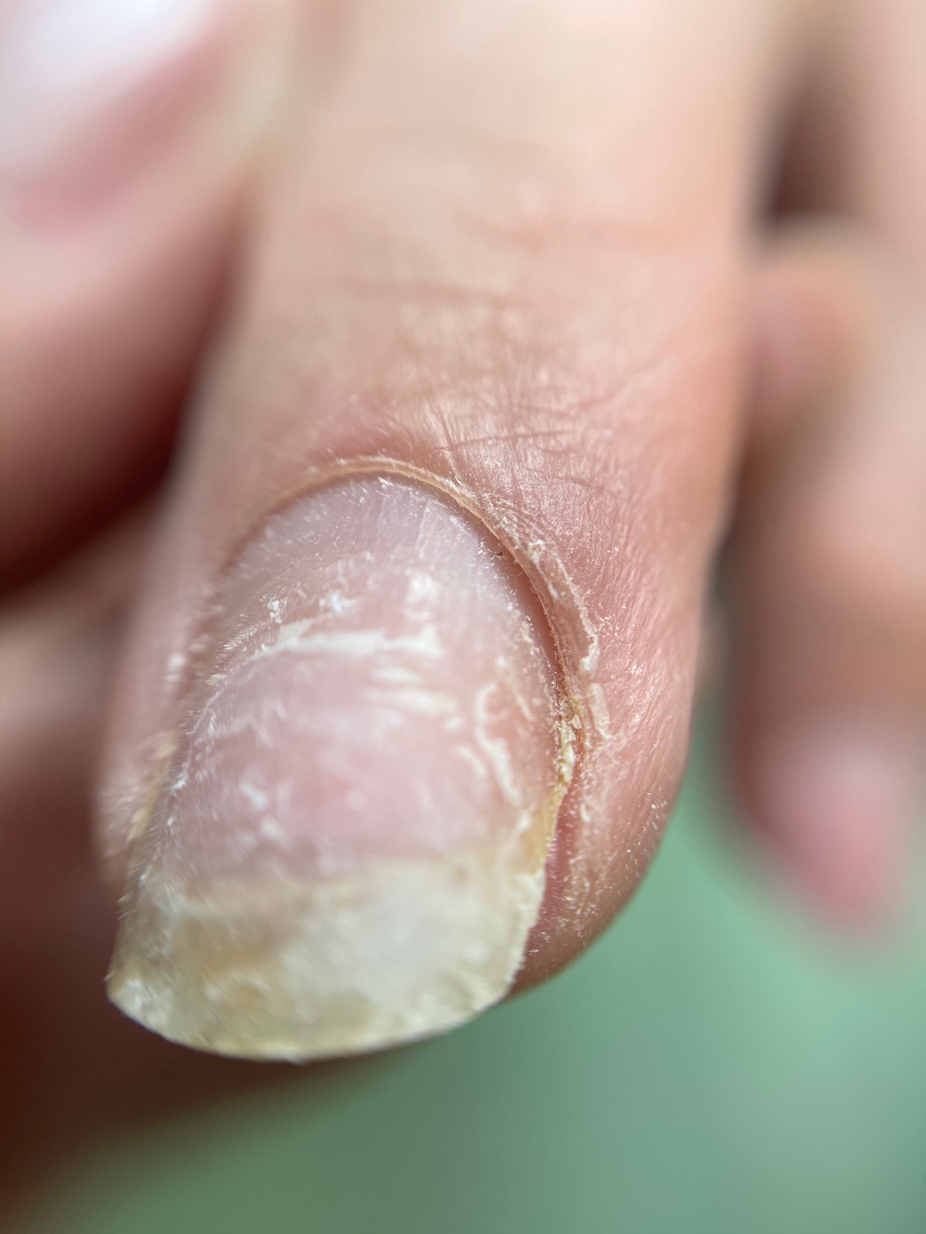 Detalle lateral de la uña natural antes de realizar la manicura.
