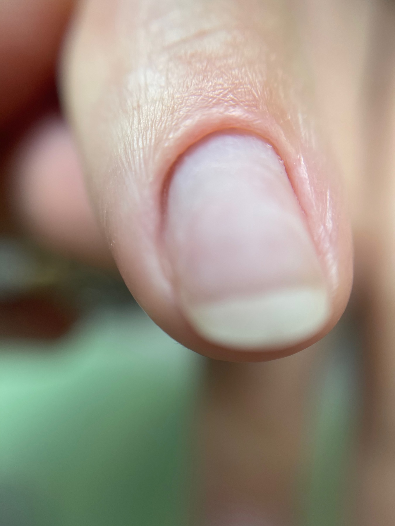 Detalle de la misma uña después de la manicura, antes del acabado de color.